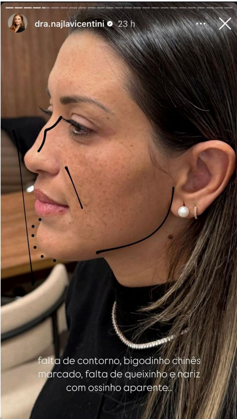 Perfil — Antes