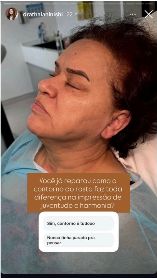 Contorno facial — Educativo com enquete — Enquete