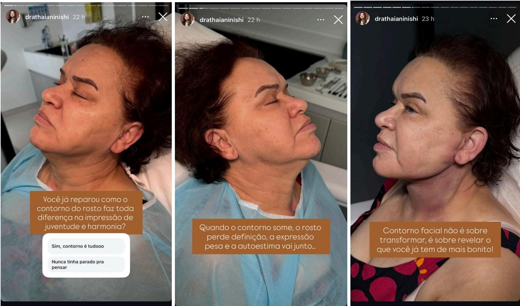 Contorno facial — Educativo com enquete — Dor