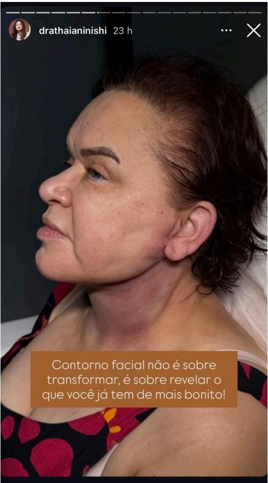 Contorno facial — Educativo com enquete — Reflexão