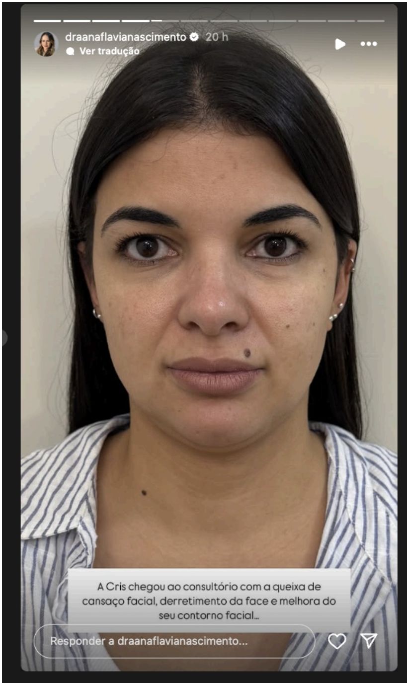 Cris — Devolvendo a segurança — Antes