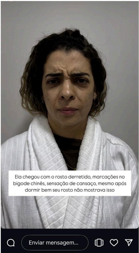 Confiante e radiante — 3 telas — Antes