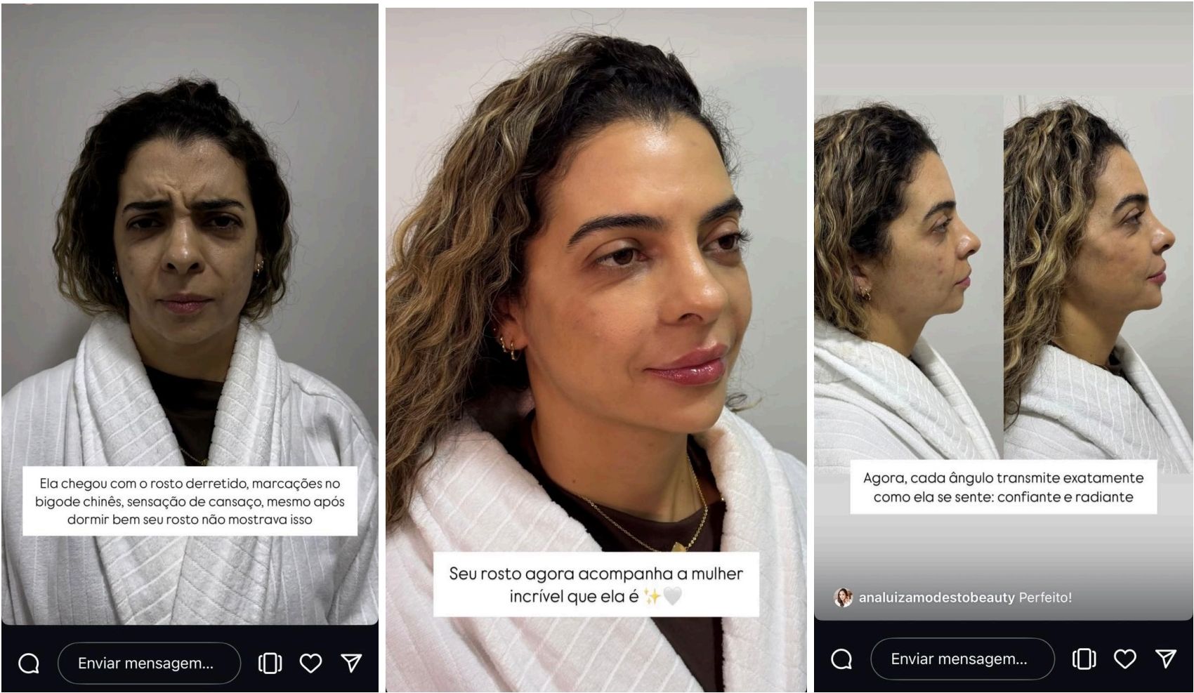Confiante e radiante — 3 telas — Comparação