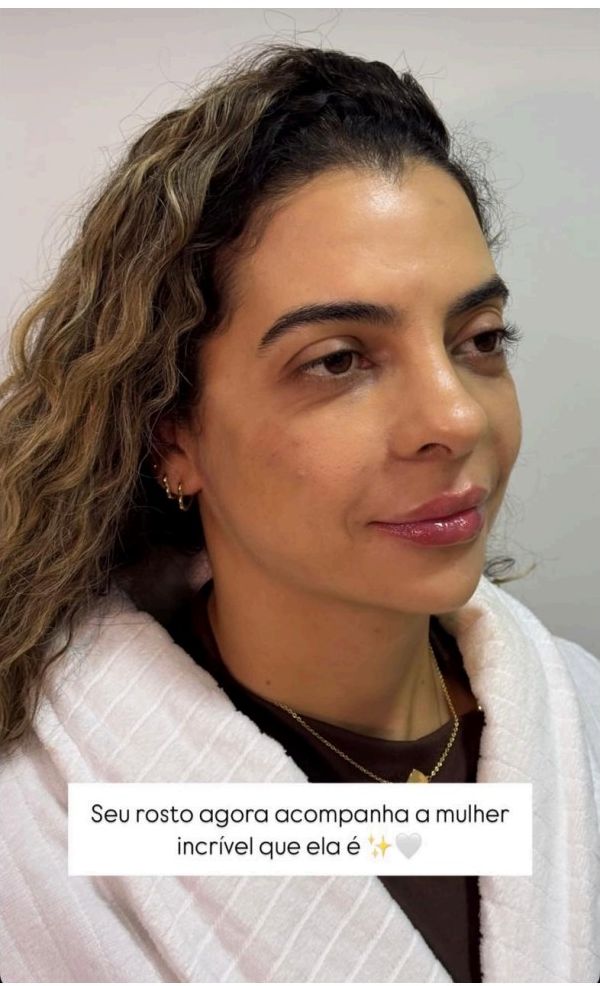 Confiante e radiante — 3 telas — Depois